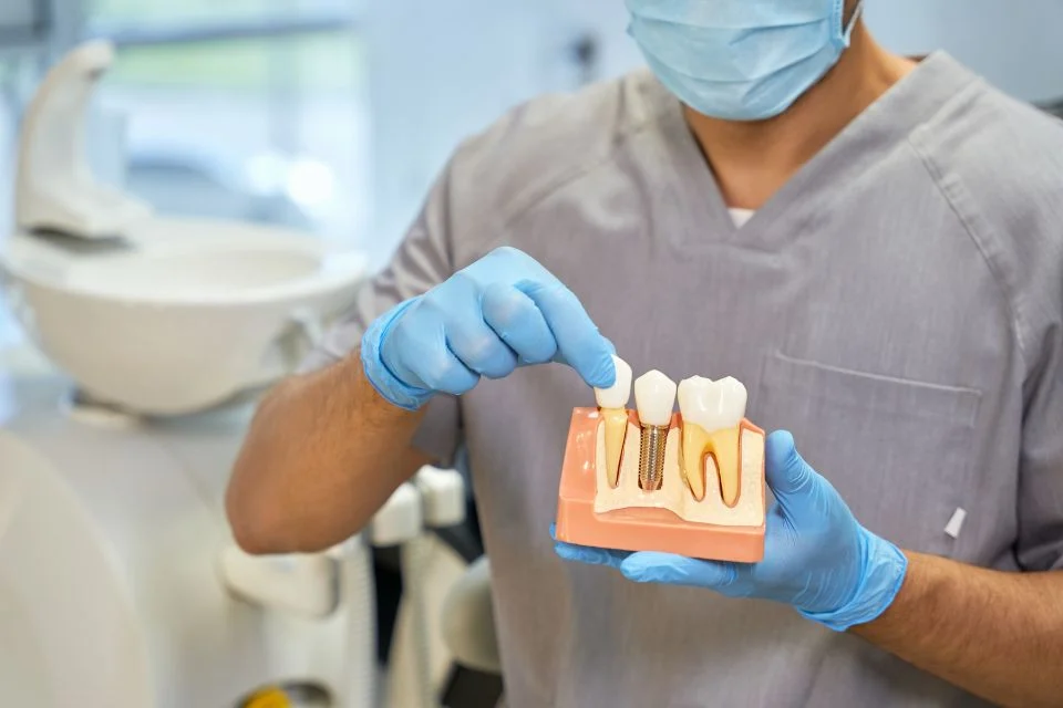 All on 4推薦嗎？專業牙醫為什麼都推all-on4全口重建？
